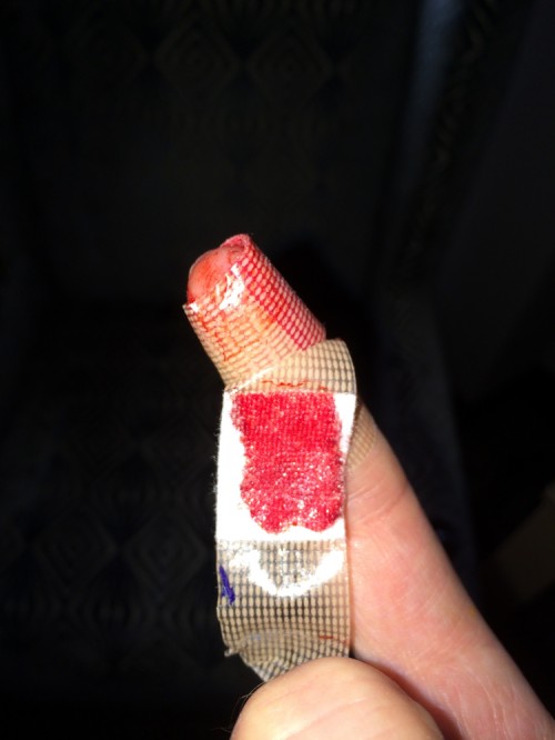 Bloody Palette Knife Accident